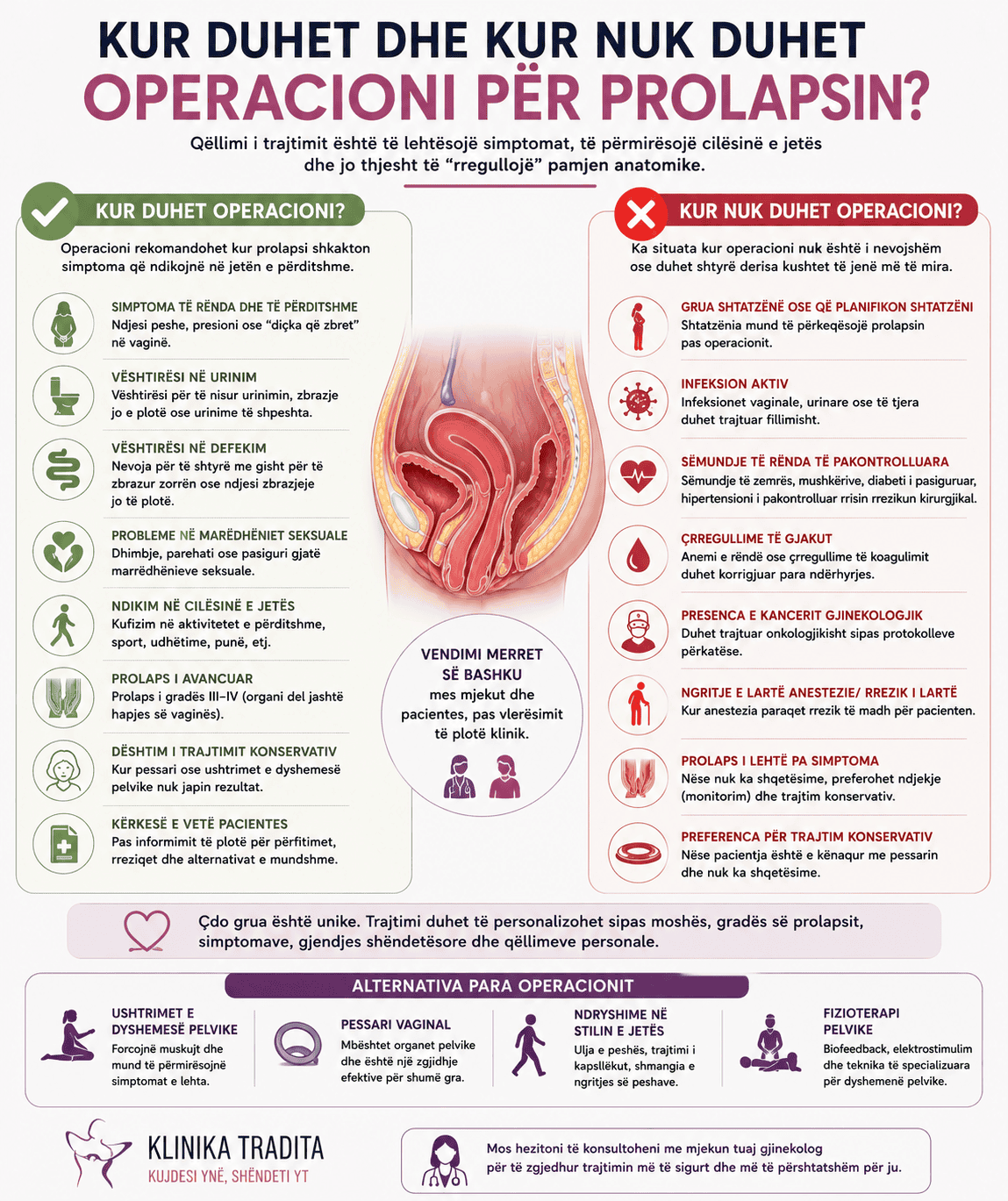 Diagramë e operacionit për prolapsin me shpjegime.