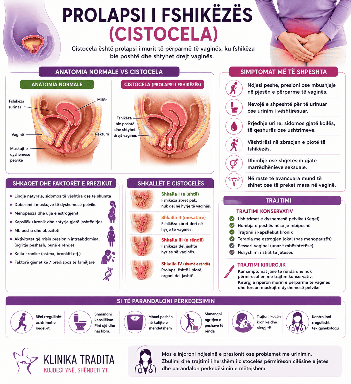 Prolapsi i fshikezes. Cistocela