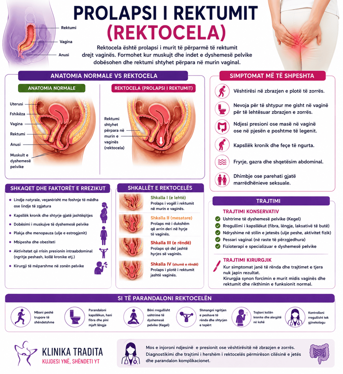 Prolapsi i rektumit. Rektocela
