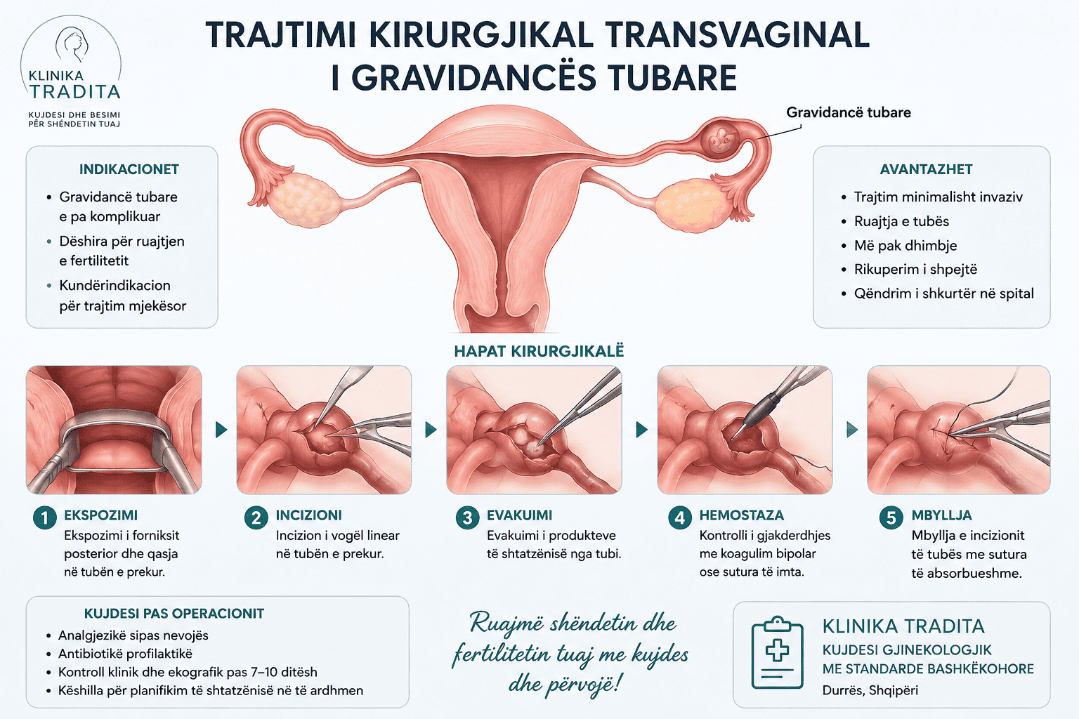 Trajtimi kirurgjikal transvaginal i gravidannces tubare 