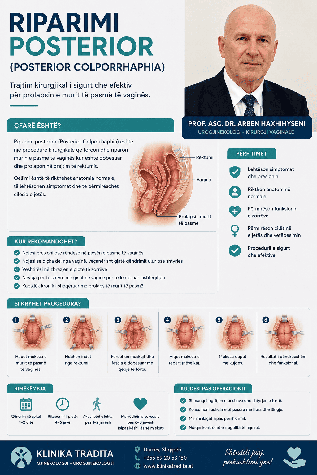 Diagram i riparimit të dyshemesë pelvike për prolapsin e mitrës.