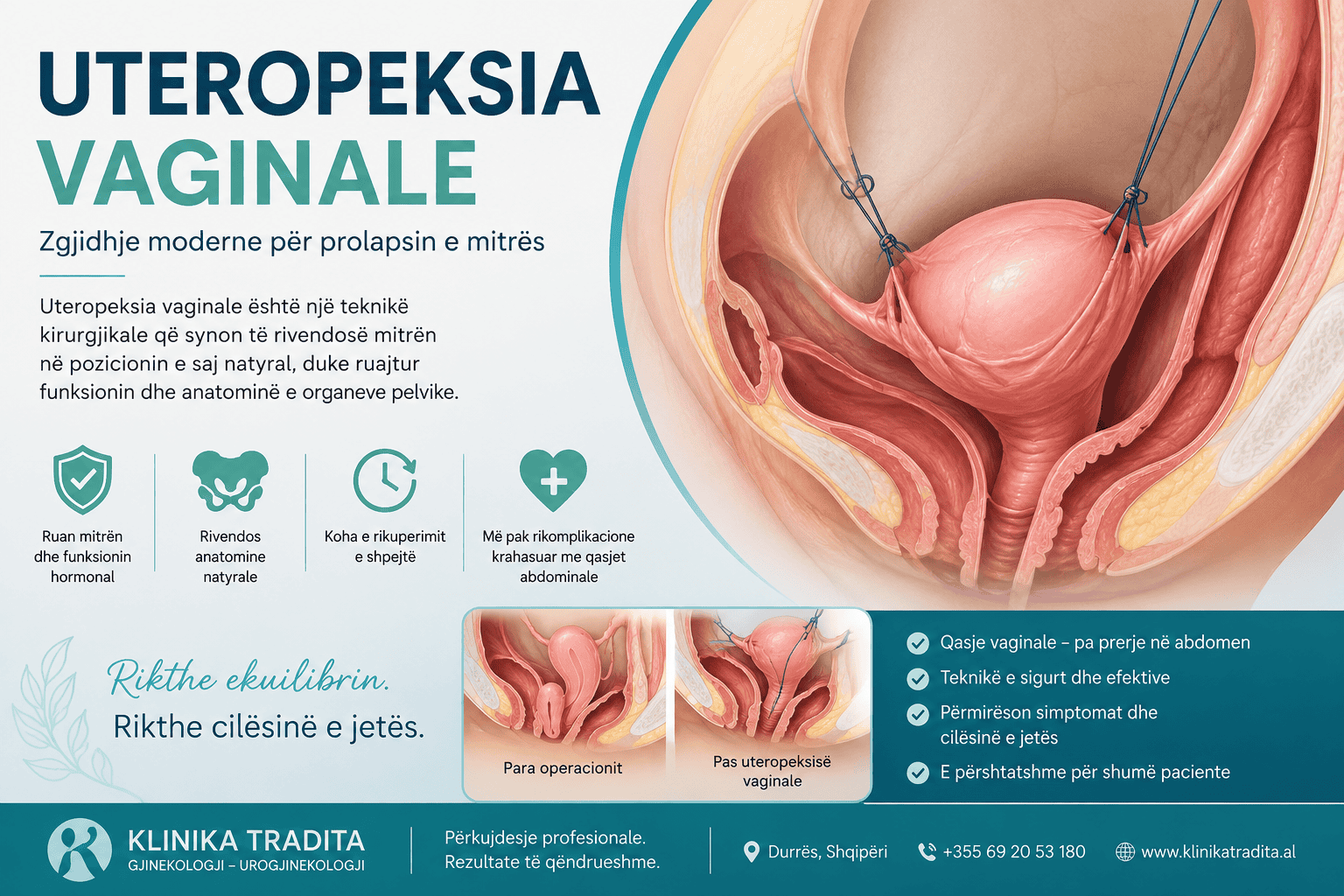 Detailed view of vaginal uteropexy surgery with surgical tools and anatomy.